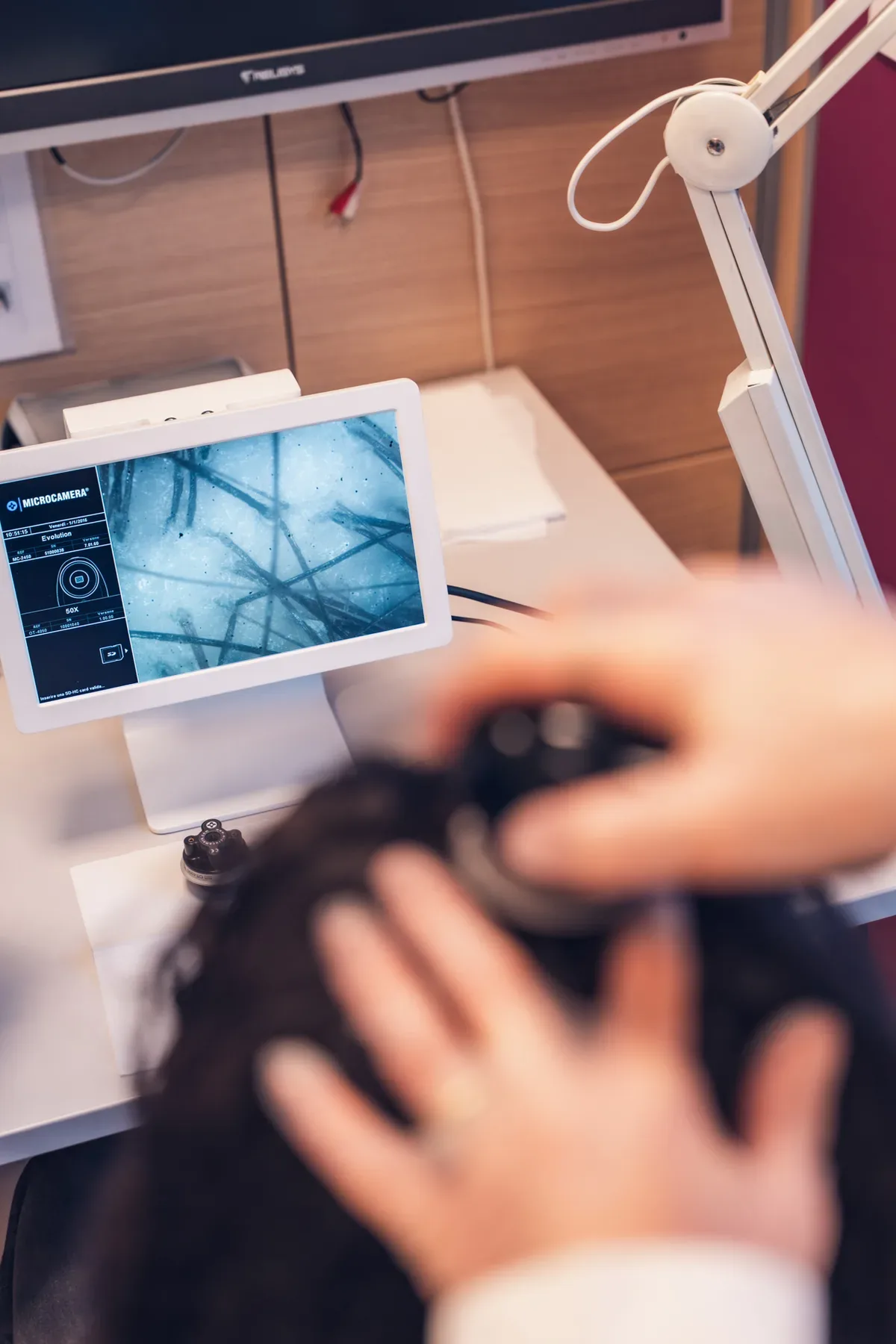 Analisi del cuoio capelluto con microcamera in un centro Istituto Giglio